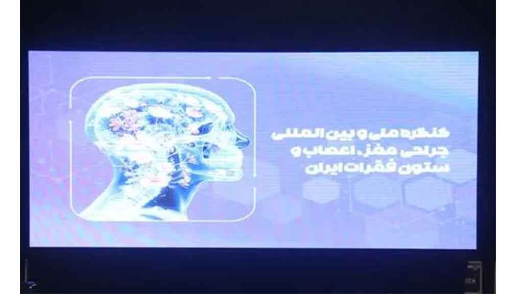آغاز به کار کنگره ملی جراحی مغز و اعصاب در رشت